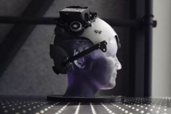 Imagen de una cabeza artificial con la neuroprótesis